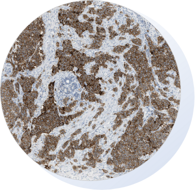 Alpha-9 Oncologys | Radiopharmaceuticals | Cancer Therapy | Approach